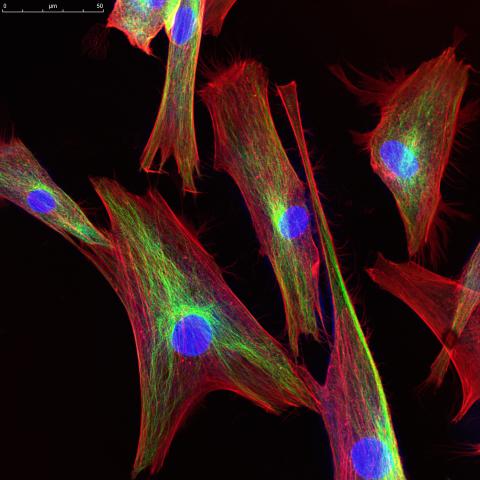 Filaments d'actine